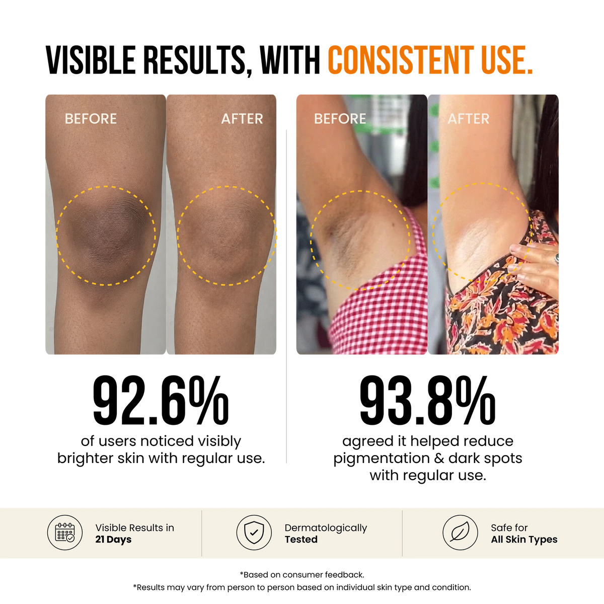 Before and after photographs of knees and underarms