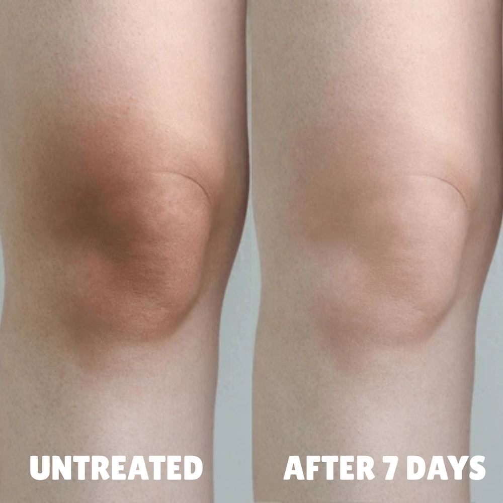 Uneven-looking knees.
