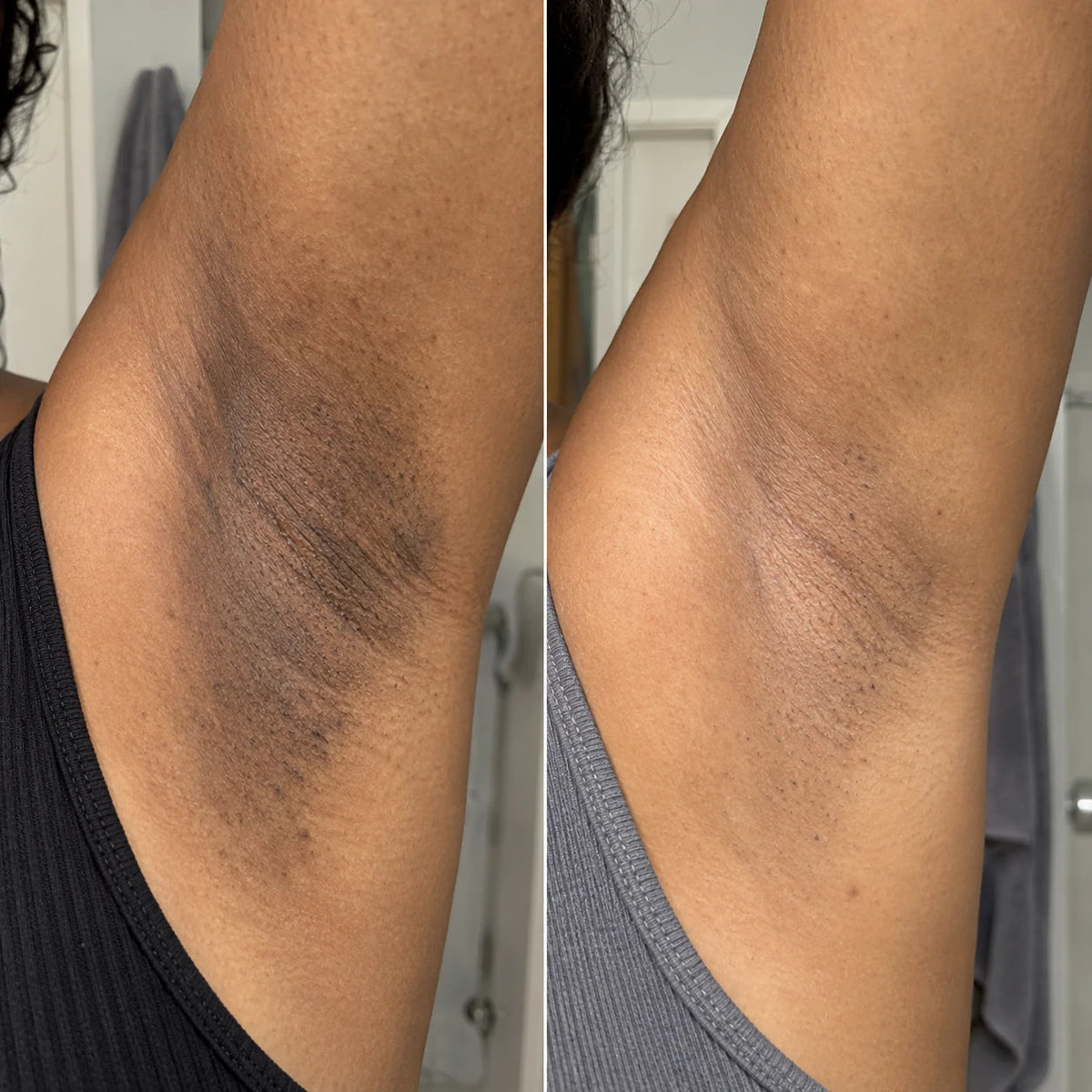 Before and after underarms