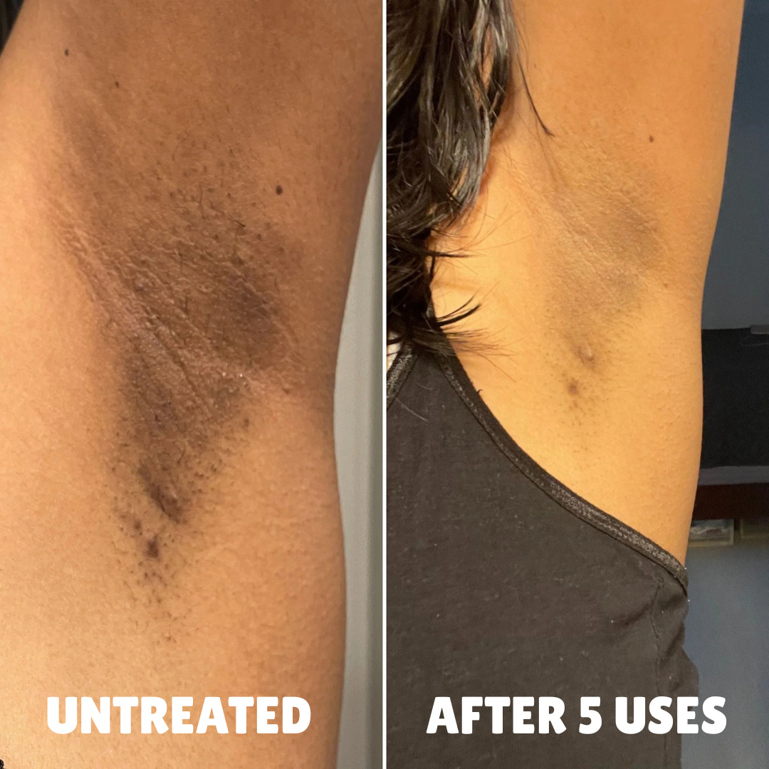 Before and after underarms and neck, unchanged source photographs